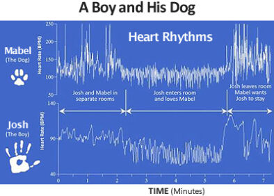 ECG heart rhythms